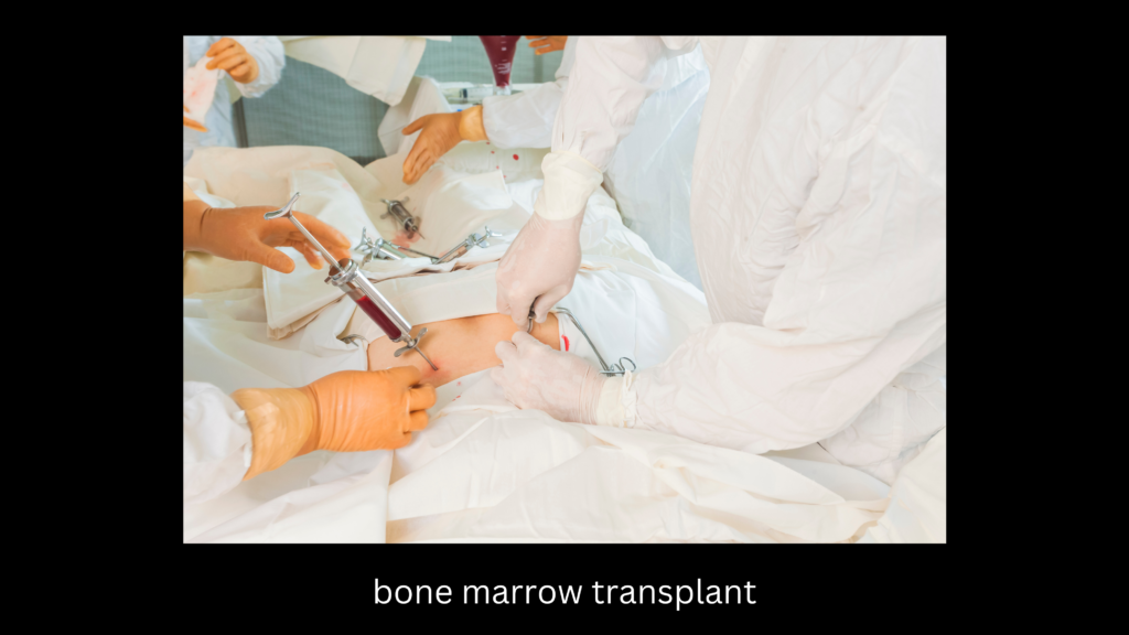 Bone marrow transplantation